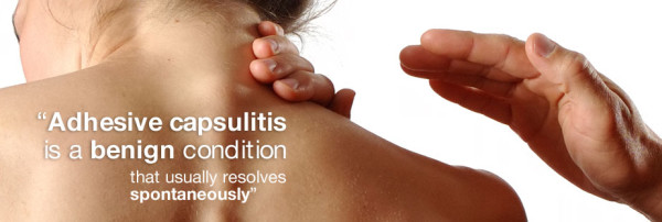 Adhesive capsulitis